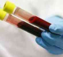 Indicatorii cheie cu formula de leucocite din sânge și interpretarea