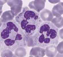 Ce neutrofilelor în sânge