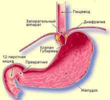 Boala gastrită reflux biliar