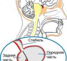Boala pituitara