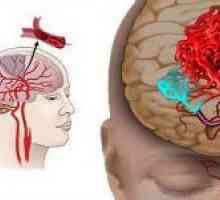 Boli cerebrale de origine vasculară