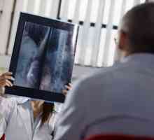De ce este o radiografie a stomacului cu bariu?