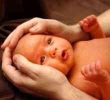 Icterul la nou-născuți - simptome și tratament
