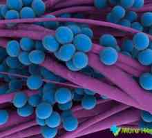 Staphylococcus aureus la copii - fie că este vorba de periculos, iar atunci când este necesar să…