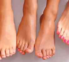 Pruritul si roseata a pielii de pe picior: prima alarmă