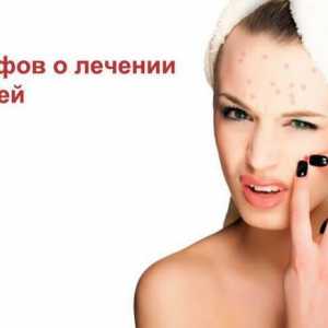 11 Mituri despre acnee!