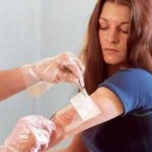 Abcesul pielii - simptome și tratament