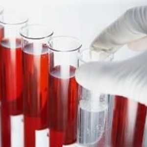 Analizele de sange, de cercetare cu privire la hormoni și decodare