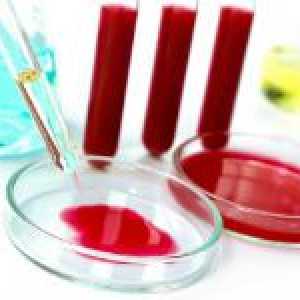 Ceea ce înseamnă o rată de sedimentare a hematiilor crescută în sânge?