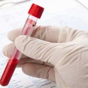 Un test de sânge pentru opisthorchiasis - preparare, procedura, decodificare și tratamentul bolilor…
