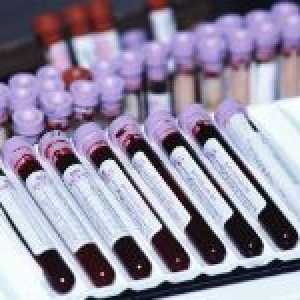Analiza de biochimie sânge și norme ale indicatorilor de bază