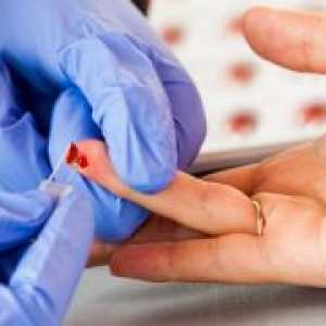 Test de sange - NST: hematocrit normal și motivul respingerii