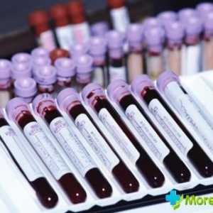 Un test de sânge în timpul sarcinii: descifrarea indicatorilor de bază