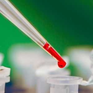 Un test de sânge a fost ghemuita: ce poate să însemne asta?