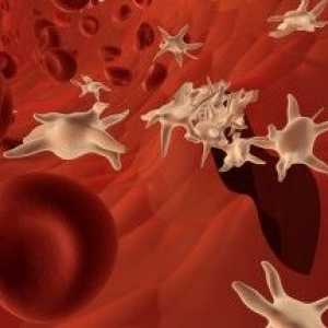 Analizele au arătat că trombocitele reduse în sânge, ceea ce înseamnă și cum să ridice nivelul de…