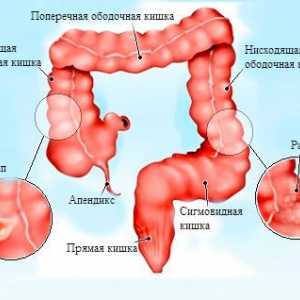 Structura anatomica, bolile și tratamentul colonului sigmoid