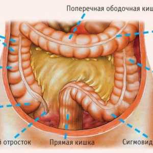 Anatomia și boli ale colonului