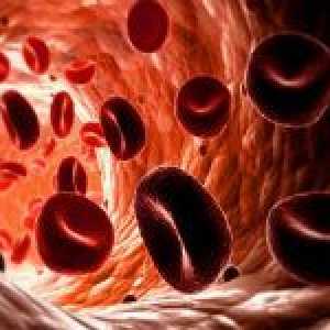 Principalele motive pentru nivelurile scăzute ale hemoglobinei din sânge
