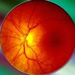 Ochii angiopatie retiniene la copii