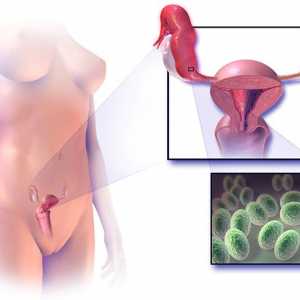 Apoplexie ovarian: patologie vasculară