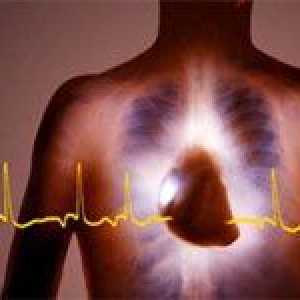 Sinus (sinus), bătăi neregulate ale inimii