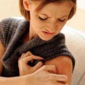 Dermatita atopică - Cauze și abordări moderne de tratament