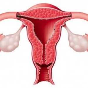 Atrezia colului uterin la femeile aflate la menopauza