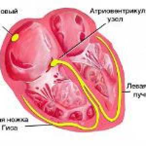 Bloc atrioventricular inima