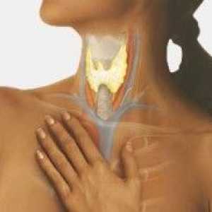 Hipotiroidism autoimuna ca urmare a tiroidita