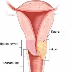 Sfatul bunicii impotriva formatiunilor pe colul uterin