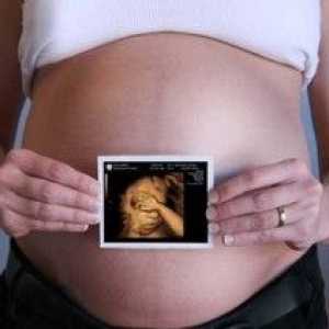 Este sigur la ultrasunete in timpul sarcinii?