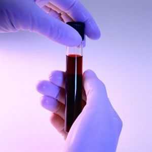 Analiza biochimică a sângelui: prepararea, deținerea, decodarea și rata