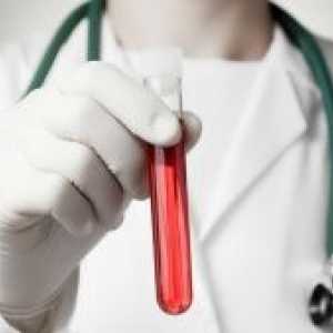 Biochimie de sange - care prezinta analiza: caracterizarea și decodificarea indicatorilor de bază