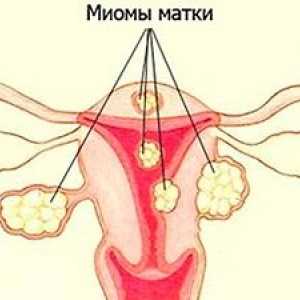 Durere în abdomen și spate în timpul menopauzei
