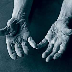 Dureri la nivelul articulatiilor degetelor: tratamentul și prevenirea