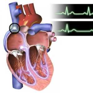Bradicardie (frecvență cardiacă scăzută) la copii și adulți: specii, origine, simptome, diagnostic,…