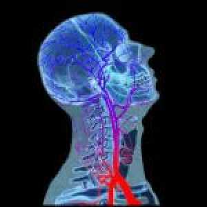Ischemia cerebrală și consecințele sale