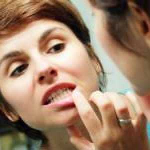 Ce se poate face cu sangerarea gingiilor