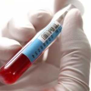 Norma alp în analiza biochimică a sângelui și provoacă anomalii enzimatice