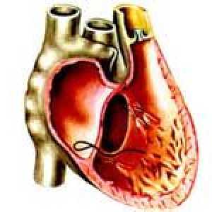 Cauzele și tratamentul insuficienței cardiace ventriculare stângi