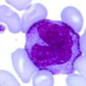 Arată că monocitele într-un test de sânge?