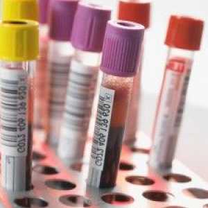Ce este un ASAT test de sânge și atunci când avem nevoie pentru a lua