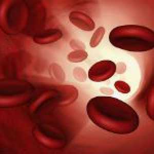 Ce este anemia sânge