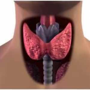 Ce este hipotiroidism și modul în care această condiție este tratată