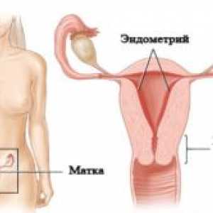 Ce este hipoplazie endometru?
