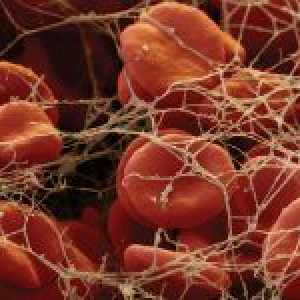 Ce este coagularea sângelui și cum să se determine