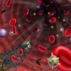 Ce este lupus anticoagulant și valoarea sa de diagnostic