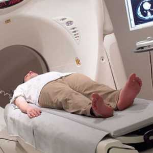 Ce este tomografia computerizata a abdomenului?