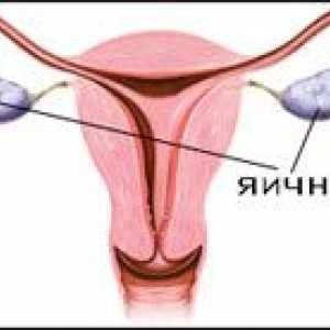 Disfuncții ovariene (tulburări de lucrări ovariene)