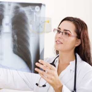 În cazul în care face radiografia toracică și Flyurografiya și cât de mult costă?